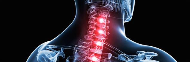 Spinal Cord Injuries